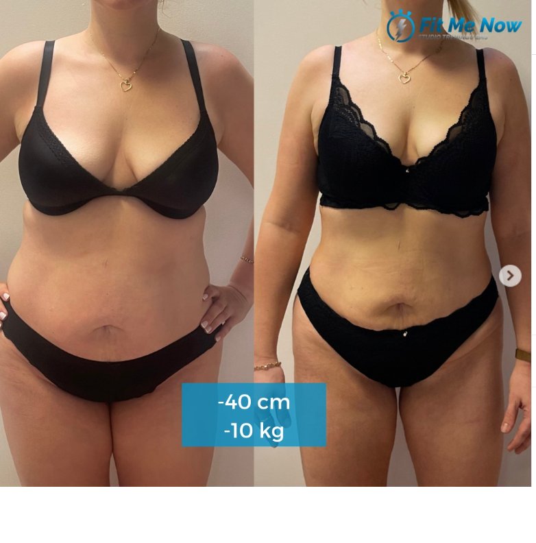 Przemiana Sylwii — efekty treningu EMS i endermologii LPG w Fit Me Now